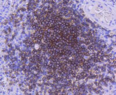 Immunohistochemistry-Paraffin: CD21 Antibody (SC0681) [NBP2-67605]