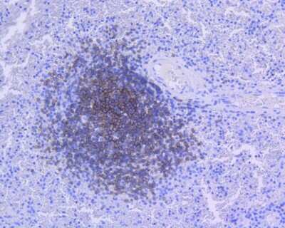 Immunohistochemistry-Paraffin: CD21 Antibody (SC0681) [NBP2-67605]