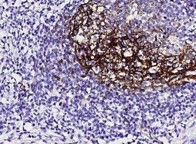 Immunohistochemistry-Paraffin: CD23/Fc epsilon RII Antibody (160) [NBP2-89366]
