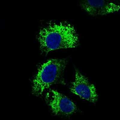 Immunocytochemistry/ Immunofluorescence: CD25/IL-2R alpha Antibody (1B5D12) - BSA Free [NBP2-37349]