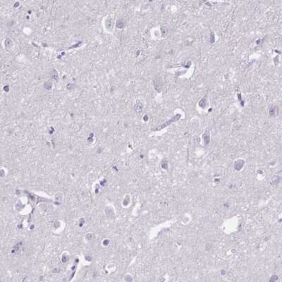 Immunohistochemistry-Paraffin: CD25/IL-2R alpha Antibody [NBP2-38730]