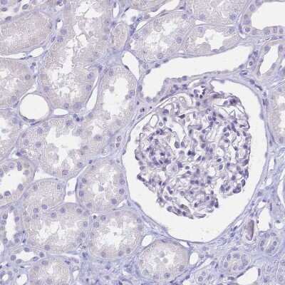 Immunohistochemistry-Paraffin: CD25/IL-2R alpha Antibody [NBP2-38730]