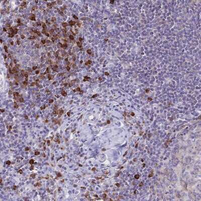 Immunohistochemistry-Paraffin: CD25/IL-2R alpha Antibody [NBP2-38730]