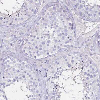 Immunohistochemistry-Paraffin: CD25/IL-2R alpha Antibody [NBP2-38730]