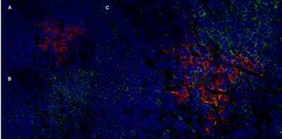Immunocytochemistry/ Immunofluorescence: CD25/IL-2R alpha Antibody (OX-39) - BSA Free [NB100-64761]