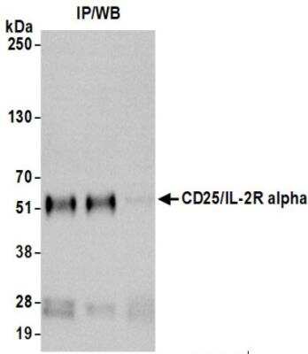 Immunoprecipitation: CD25/IL-2R alpha Antibody (BLR157J) [NBP3-14733]