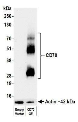 Western Blot: CD27 Ligand/TNFSF7/CD70 Antibody (BLR176J) [NBP3-14748]