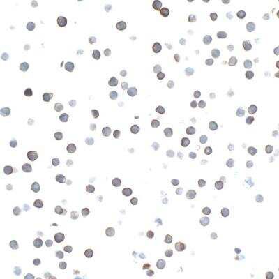Immunocytochemistry: CD27/TNFRSF7 Antibody (BLR083G) [NBP2-78837]