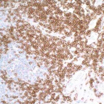Immunohistochemistry-Paraffin: CD27/TNFRSF7 Antibody (BLR083G) [NBP2-78837]