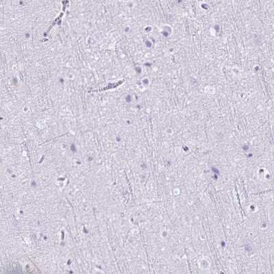 Immunohistochemistry-Paraffin: CD27/TNFRSF7 Antibody [NBP2-38434]