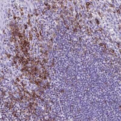 Immunohistochemistry-Paraffin: CD27/TNFRSF7 Antibody [NBP2-38434]