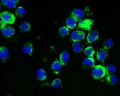 Immunocytochemistry/ Immunofluorescence: CD27/TNFRSF7 Antibody (JB40-98) [NBP2-75434]