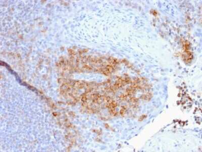 Immunohistochemistry-Paraffin: CD27/TNFRSF7 Antibody (LPFS2/1611) [NBP2-53196]