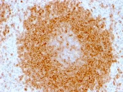 Immunohistochemistry-Paraffin: CD27/TNFRSF7 Antibody (LPFS2/1611) [NBP2-53196]