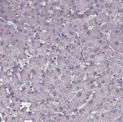 Immunohistochemistry-Paraffin: CD28 Antibody [NBP2-57015]
