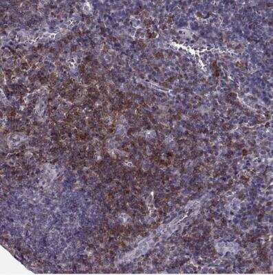 Immunohistochemistry-Paraffin: CD28 Antibody [NBP2-57015]