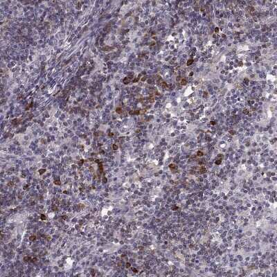 Immunohistochemistry-Paraffin: CD28 Antibody [NBP2-57015]