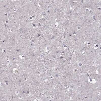 Immunohistochemistry-Paraffin: CD28 Antibody [NBP2-57015]