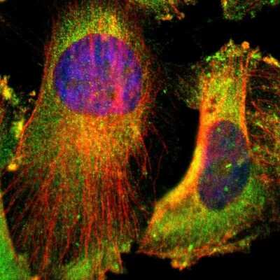 Immunocytochemistry/ Immunofluorescence: CD2AP Antibody [NBP1-90625]
