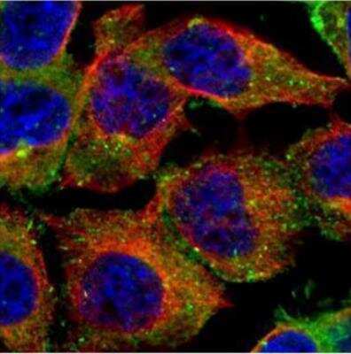 Immunocytochemistry/ Immunofluorescence: CD2AP Antibody [NBP2-53098]