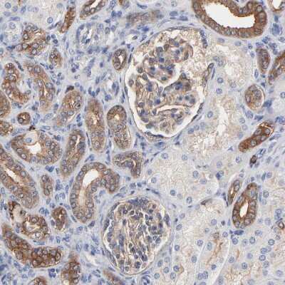 Immunohistochemistry-Paraffin: CD2AP Antibody [NBP1-90626]
