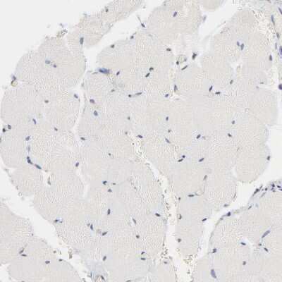 Immunohistochemistry-Paraffin: CD2AP Antibody [NBP1-90626]