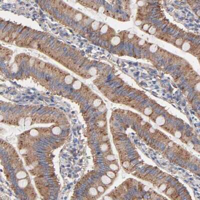 Immunohistochemistry-Paraffin: CD2AP Antibody [NBP1-90626]