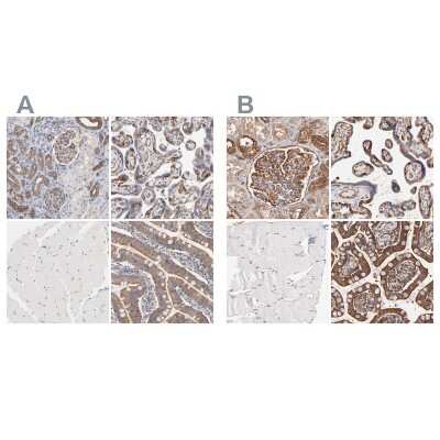 Immunohistochemistry-Paraffin: CD2AP Antibody [NBP1-90626]