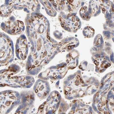 Immunohistochemistry-Paraffin: CD2AP Antibody [NBP1-90626]