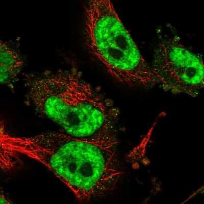 Immunocytochemistry/ Immunofluorescence: CD2BP2 Antibody [NBP2-47516]