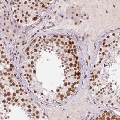 Immunohistochemistry-Paraffin: CD2BP2 Antibody [NBP2-49328]