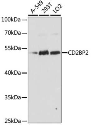 Western Blot: CD2BP2 AntibodyAzide and BSA Free [NBP2-92262]