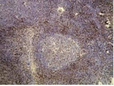 Immunohistochemistry-Paraffin: CD3 Antibody (N26-R) [NBP1-79054]