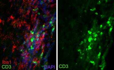 Immunohistochemistry-Frozen: CD3 Antibody (SP7) [NB600-1441]