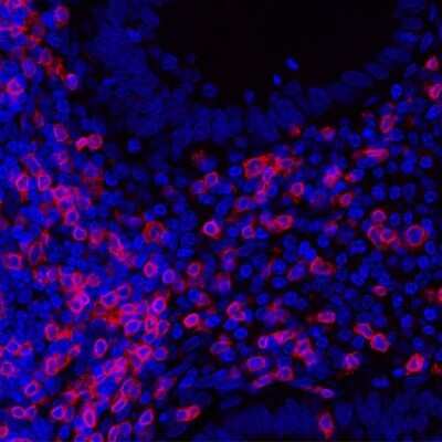 Immunocytochemistry/ Immunofluorescence: CD3 epsilon Antibody (BL-298-5D12) [NBP2-76424]