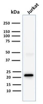 Western Blot: CD3 epsilon Antibody (C3e/1308) [NBP2-53387]