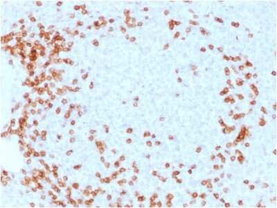 Immunohistochemistry-Paraffin: CD3 epsilon Antibody (C3e/1931) [NBP2-79706]