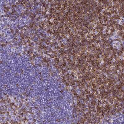Immunohistochemistry-Paraffin: CD3 epsilon Antibody (CL1497) [NBP2-34484]