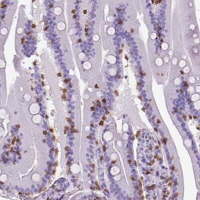Immunohistochemistry-Paraffin: CD3 epsilon Antibody (CL1497) [NBP2-34484]