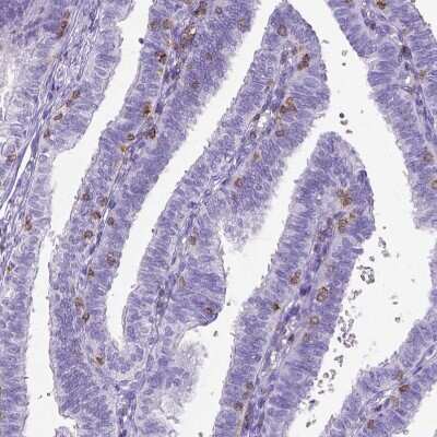 Immunohistochemistry-Paraffin: CD3 epsilon Antibody (CL1497) [NBP2-34484]