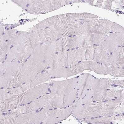 Immunohistochemistry-Paraffin: CD3 epsilon Antibody (CL1497) [NBP2-34484]