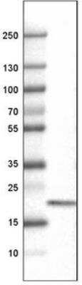 Western Blot: CD3 epsilon Antibody (CL1497) [NBP2-34484]