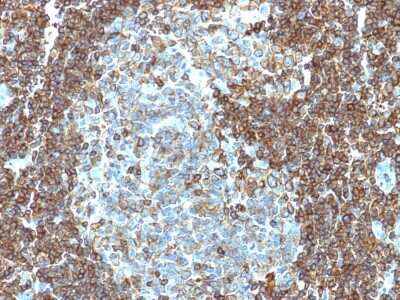 Immunohistochemistry-Paraffin: CD3 epsilon Antibody (PC3/188A) - Azide and BSA Free [NBP2-54405]