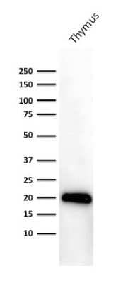 Western Blot: CD3 epsilon Antibody (PC3/188A) [NBP2-53386]