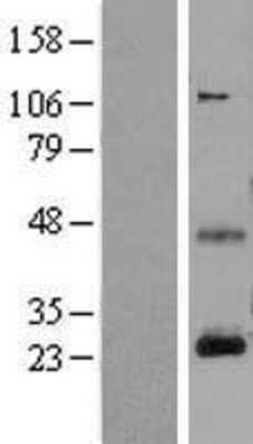 Western Blot: CD3 epsilon Overexpression Lysate [NBL1-08944]
