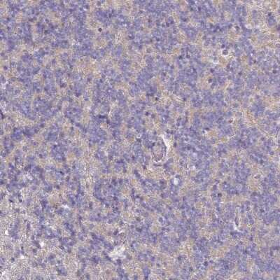 Immunohistochemistry-Paraffin: CD3 gamma Antibody [NBP2-32636]