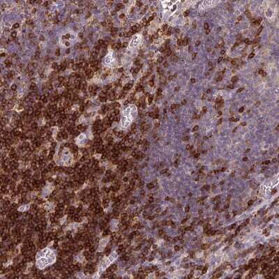 Immunohistochemistry-Paraffin: CD3 gamma Antibody [NBP2-32636]