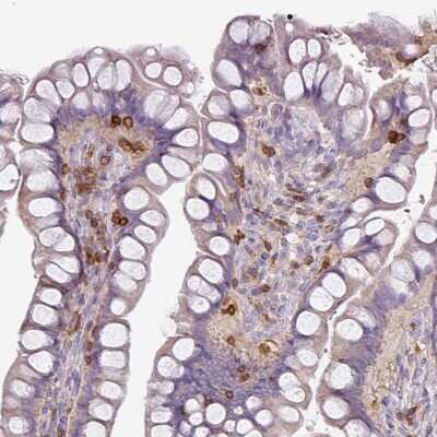 Immunohistochemistry-Paraffin: CD3 gamma Antibody [NBP2-32636]