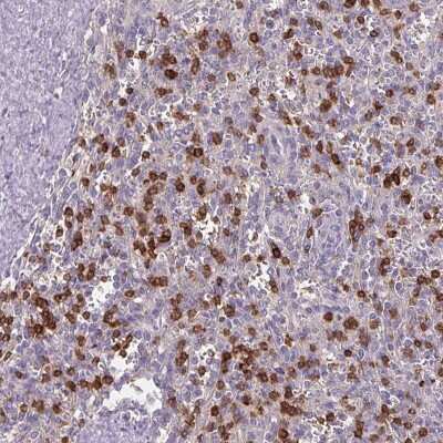 Immunohistochemistry-Paraffin: CD3 gamma Antibody [NBP2-32636]