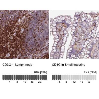 Immunohistochemistry-Paraffin: CD3 gamma Antibody [NBP2-32636]
